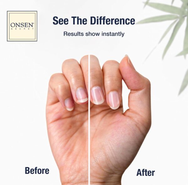 Onsen Nail & Cuticle Cream Treatment w/Japanese Tsubaki, Jojoba & Lavender Oil, Shea Butter – Strengthens Nails - Image 2